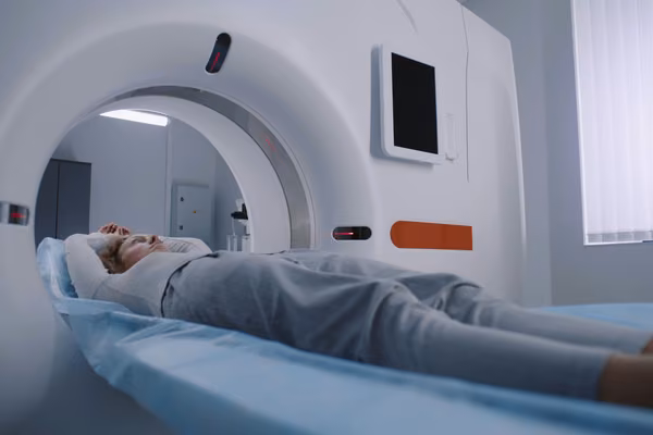 Lung cancer screening - CT scan